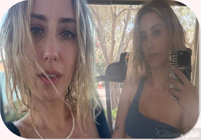 Hazal Kaya’nın yüzündeki değişim dikkat çekti’ Estetik’mi yaptırdı?