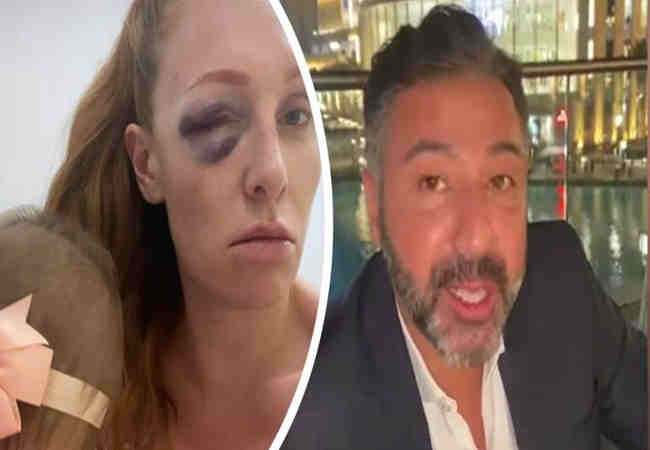 Kubilay Georgina Fleur'a vahşi saldırıyı kabul etti - Magazin Haberler!
